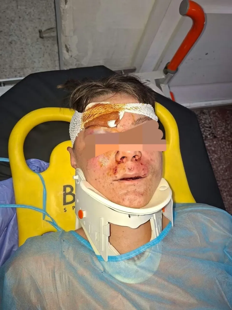 O persoană cu fața bandajată și un colier cervical medical este întinsă pe o targă de transport.
