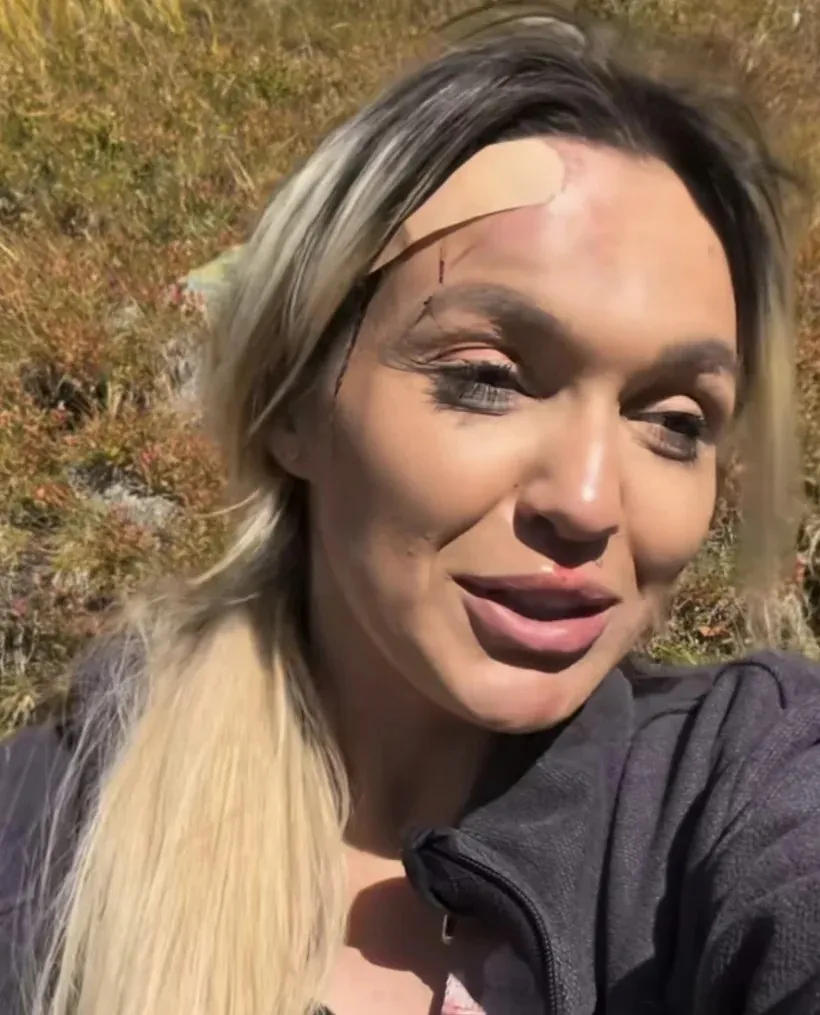 O femeie cu părul blond și deschis la culoare poartă un plasture pe frunte sub care se observă o mică vânătă.