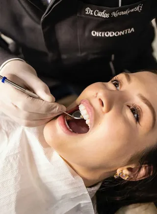 O persoană cu gura deschisă stă întinsă pe un scaun, în timp ce o mână cu mănușă albă folosește o oglindă dentară în cavitatea bucală.