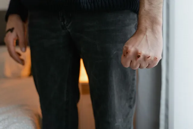 Un bărbat stă în picioare purtând pantaloni închiși, având mâna stângă strânsă într-un pumn cu urme de sânge pe degete.