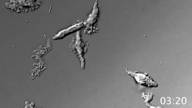 Microscopia grayscale prezintă mai multe forme de celule neregulate și alungite pe un fundal uniform de culoare gri.