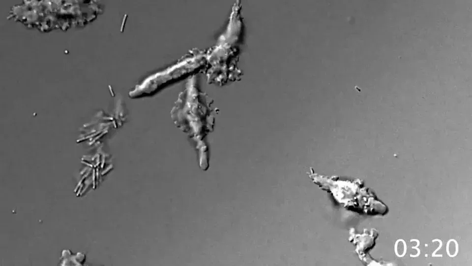 Microscopia grayscale prezintă mai multe forme de celule neregulate și alungite pe un fundal uniform de culoare gri.