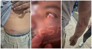 Trei imagini arată o rană pe abdomen, o rană la nivelul ochiului și o zgârietură pe antebraț.