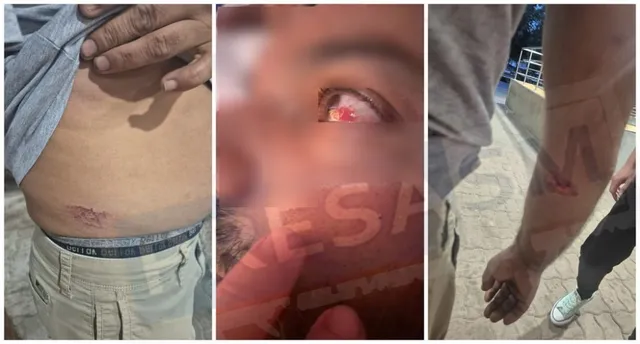 Trei imagini arată o rană pe abdomen, o rană la nivelul ochiului și o zgârietură pe antebraț.