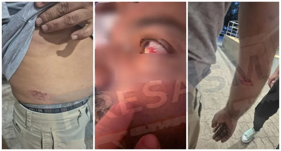 Trei imagini arată o rană pe abdomen, o rană la nivelul ochiului și o zgârietură pe antebraț.