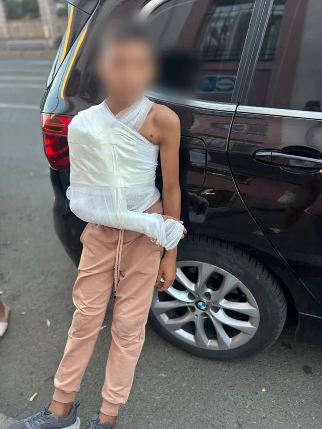 Un copil îmbrăcat în pantaloni roz și pantofi gri stă lângă o mașină neagră, având toracele și brațul drept acoperite de bandaje albe.
