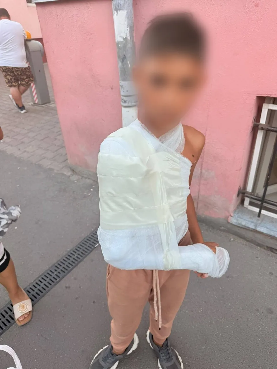 Un copil stă în picioare purtând un bandaj alb mare care îi acoperă brațul drept și partea superioară a trunchiului.
