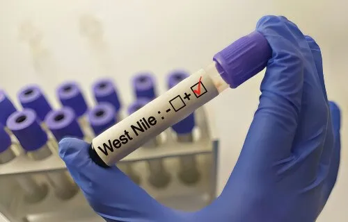 O mână îmbrăcată într-o mănușă albastră ține un recipient de probă etichetat cu textul West Nile și un semn de bifă într-un chenar roșu.