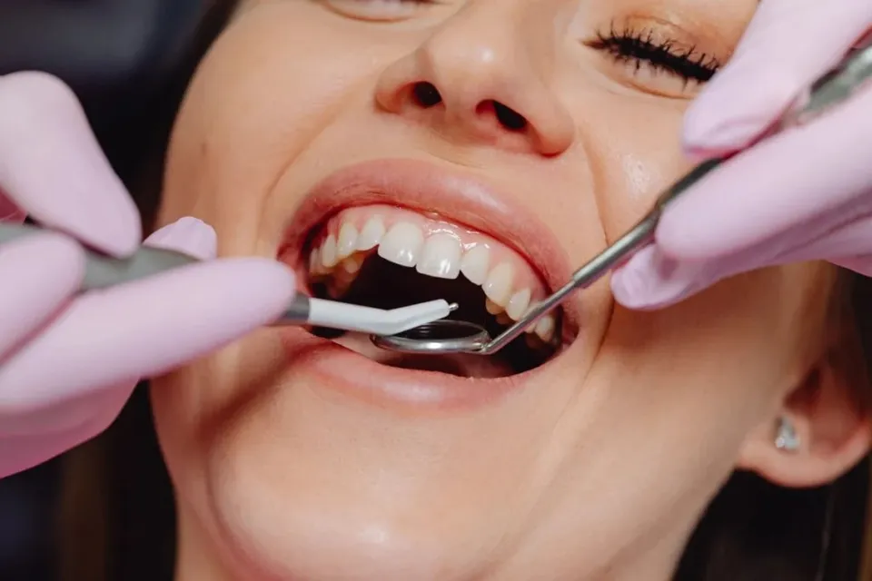 Mâini cu mănuși roz țin instrumente dentare metalice în interiorul gurii unei persoane cu dinții vizibili.