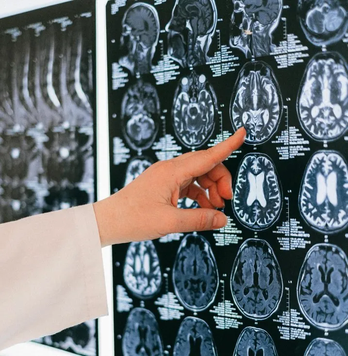 O mână într-o mânecă albă arată spre o serie de imagini de scanare cerebrală afișate pe un ecran negru.
