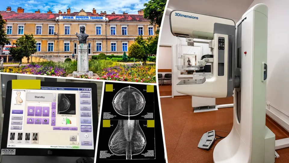 Un dispozitiv medical alb de mamografie stă într-o cameră, lângă un monitor care afișează imagini medicale și un ecran cu radiografii mamare.