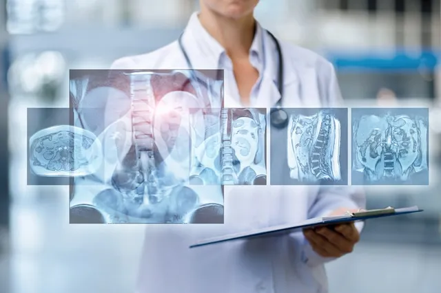 O persoană în halat alb de medic ține un dosar, având suprapuse imagini radiografice ale coloanei vertebrale și ale unor secțiuni anatomice.