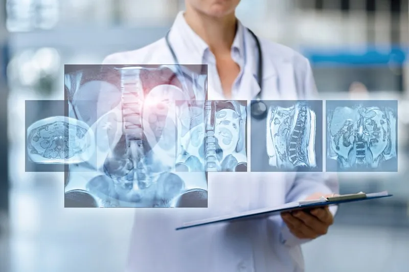 O persoană în halat alb de medic ține un dosar, având suprapuse imagini radiografice ale coloanei vertebrale și ale unor secțiuni anatomice.