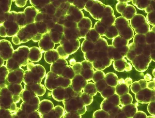 Agregări de forme sferice de culoare închisă, conturate de margini luminoase de un galben intens pe un fundal verde.