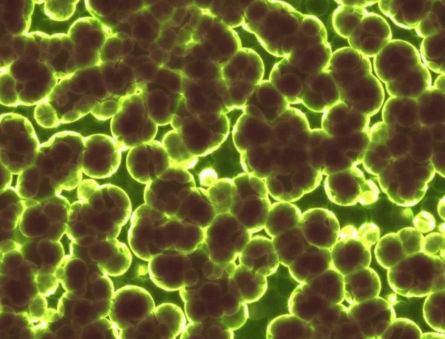 Agregări de forme sferice de culoare închisă, conturate de margini luminoase de un galben intens pe un fundal verde.