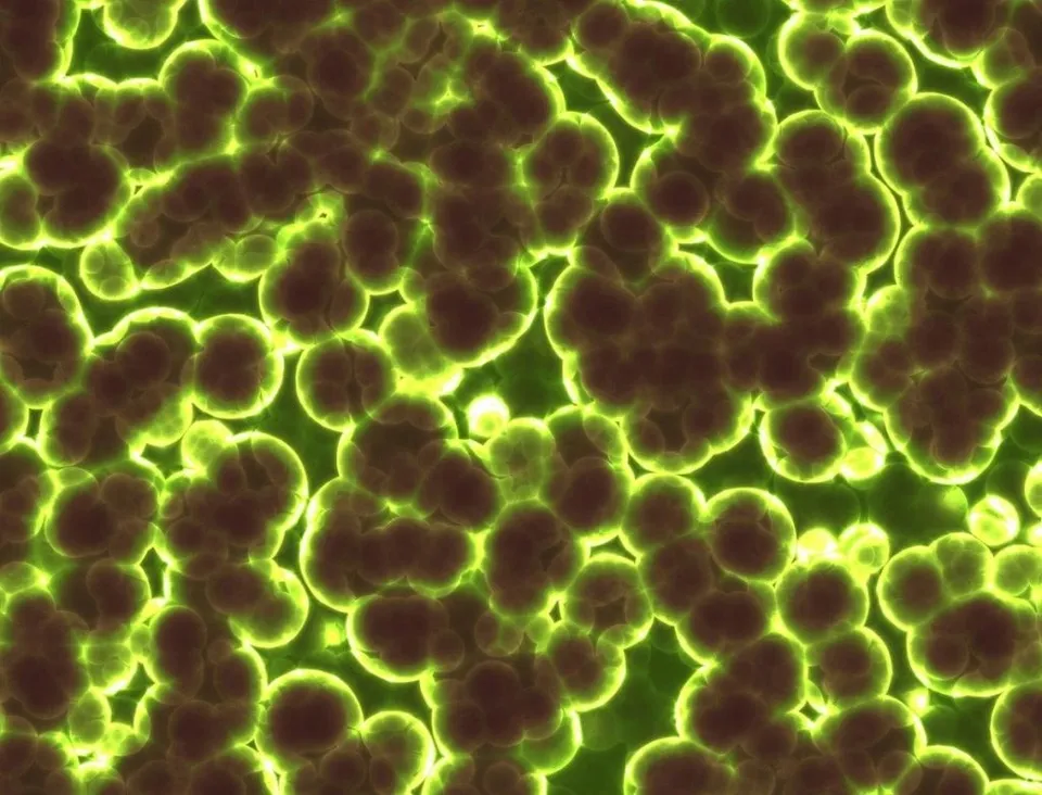 Agregări de forme sferice de culoare închisă, conturate de margini luminoase de un galben intens pe un fundal verde.